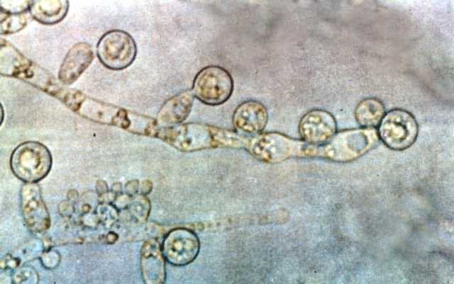 Candida_albicans