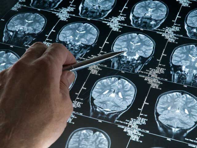 big-pharma-vasten-brein