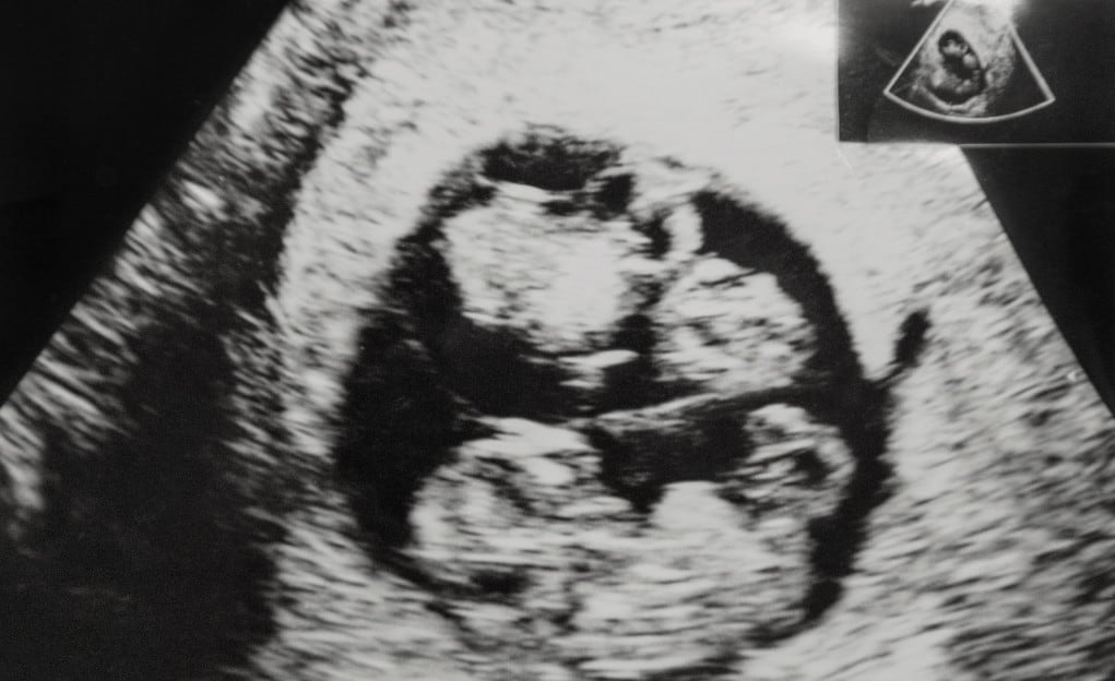 Je grootste verlies als kracht